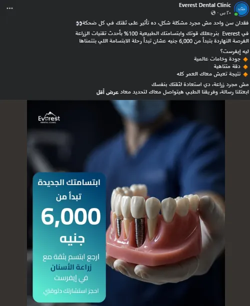 Everest Dental implants value post